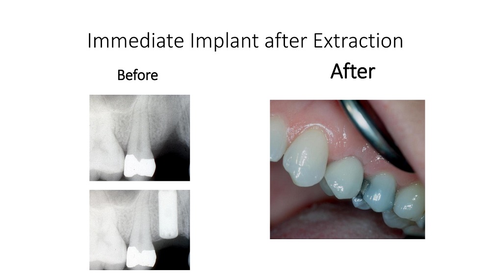 Smile Gallery Paoli PA, Oral Surgery Associates of the Main Line