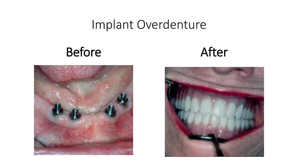 Smile Gallery Paoli PA, Oral Surgery Associates of the Main Line